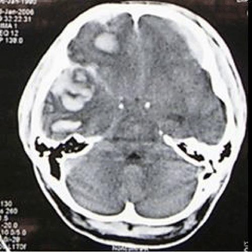 article icon