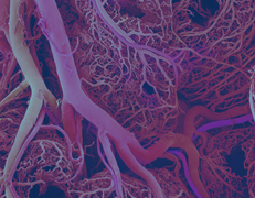 Archives of Vascular Medicine